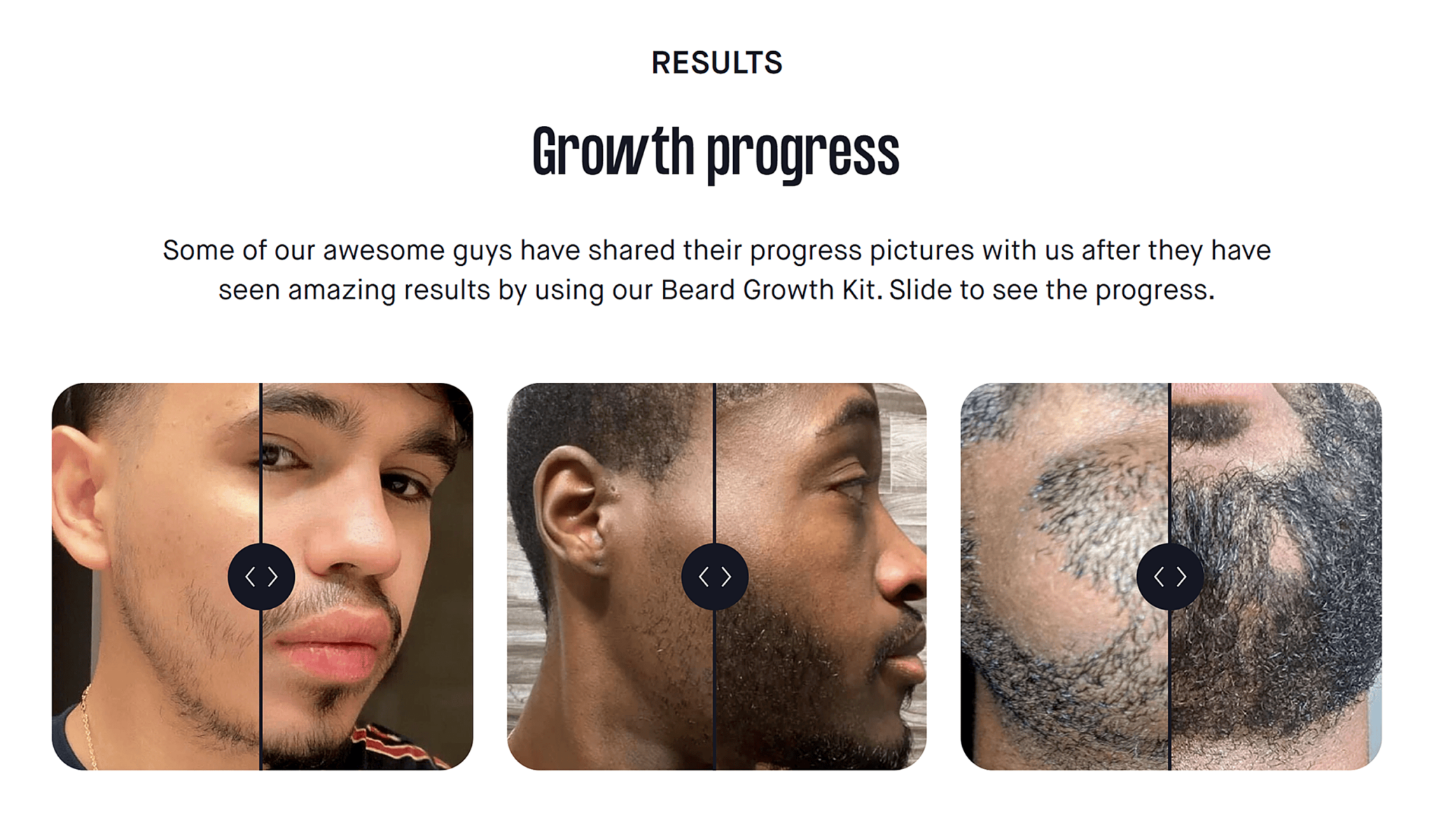 cphgrooming-growth-progress 20 Effective Product Page Examples (+ Best Practices)